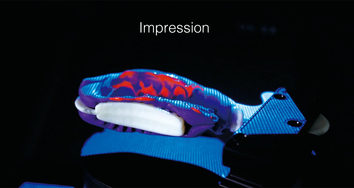 Оттиск SHINING 3D DENTAL