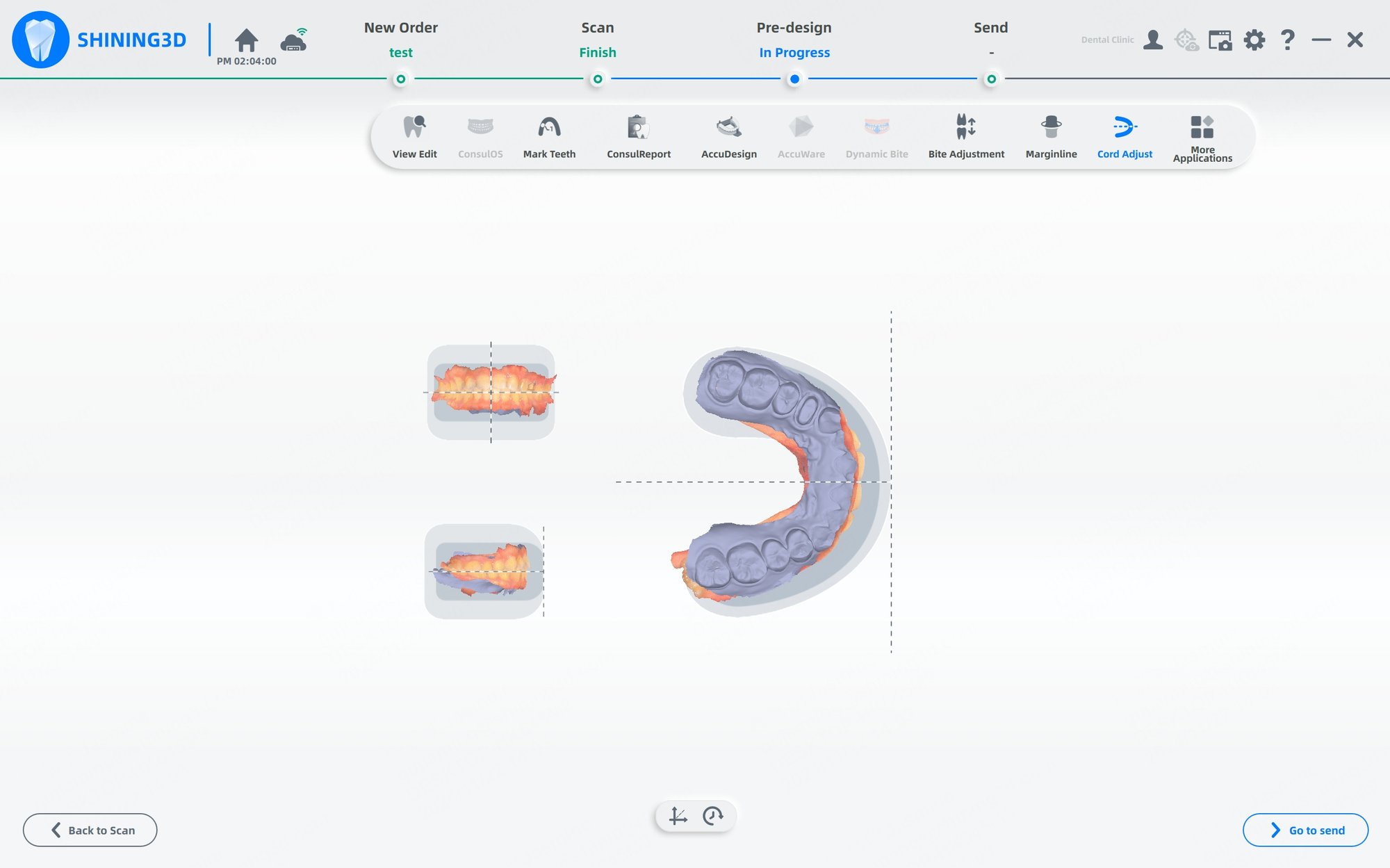 Интраоральный сканер Aoralscan 3 Функция регулировки координат